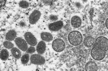 Premier séquençage complet de l'ADN du virus de la variole du singe en Suisse