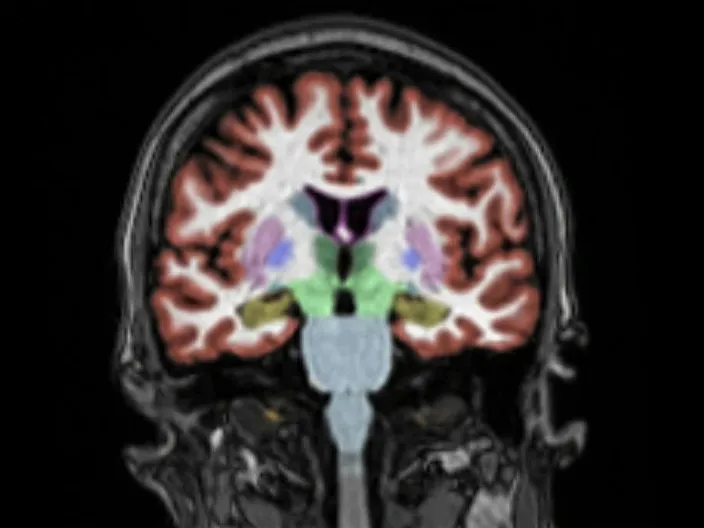 Image IRM du cerveau