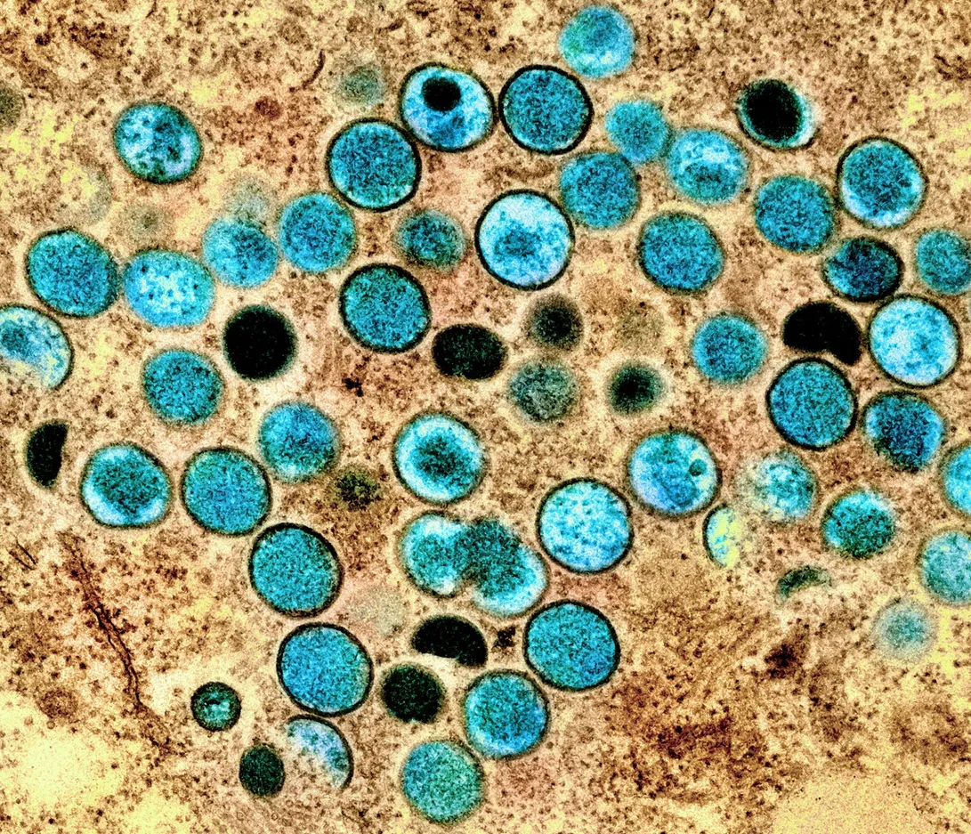Particules du virus de la variole du singe agrandies et colorisées.