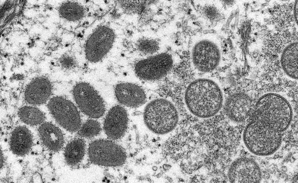Virus de la variole du singe