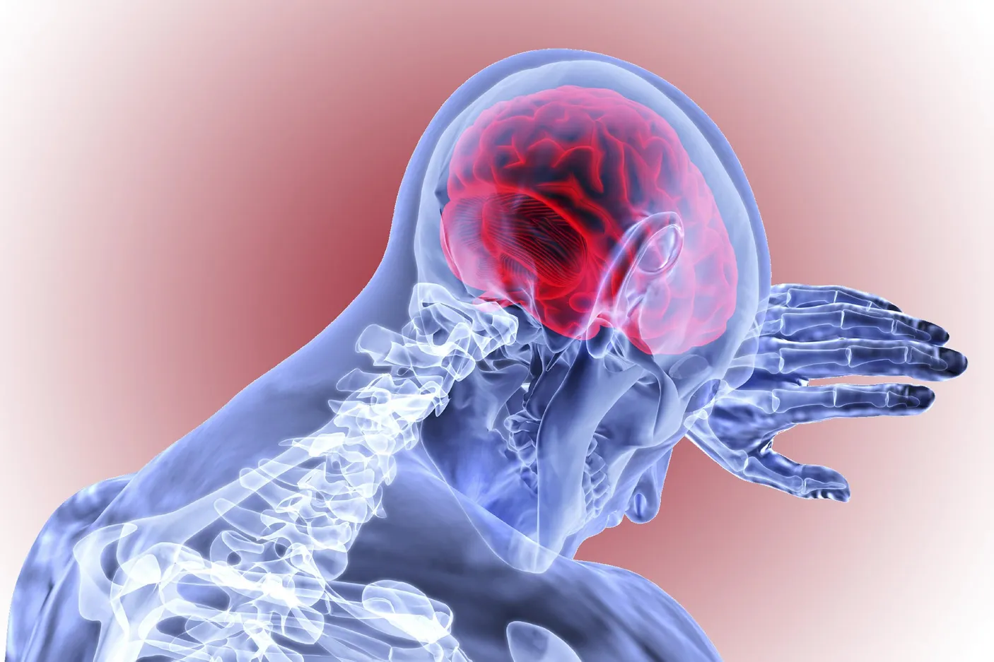 Saignement du cerveau Accident vasculaire cérébral Hémorragie