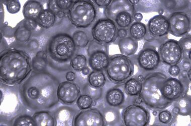 Foam That Can Deliver Bubbles of Carbon Monoxide to Gastrointestinal Tract