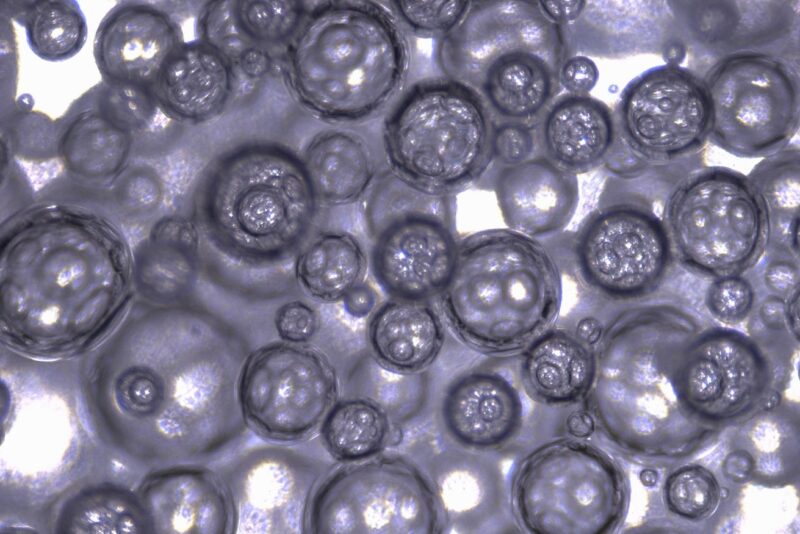Foam That Can Deliver Bubbles of Carbon Monoxide to Gastrointestinal Tract
