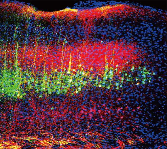 Zhou et al. ont découvert que le son réduit la douleur chez les souris en diminuant l'activité des neurones du cortex auditif du cerveau (vert et magenta) qui se projettent vers le thalamus. Crédit image : Wenjie Zhou.