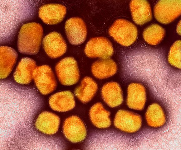 Micrographie électronique à transmission colorisée de particules de virus de la variole du singe (or) cultivées et purifiées à partir d'une culture cellulaire. Crédit image : NIAID.