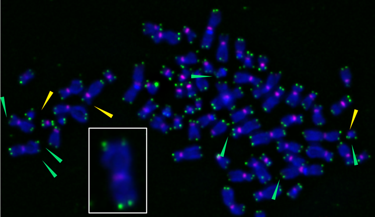 Image microscopique de chromosomes dont les télomères sont endommagés par l'oxydation.