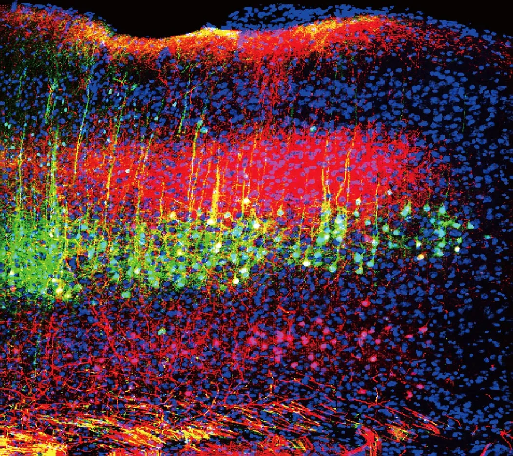 Neurones du cortex auditif de la souris