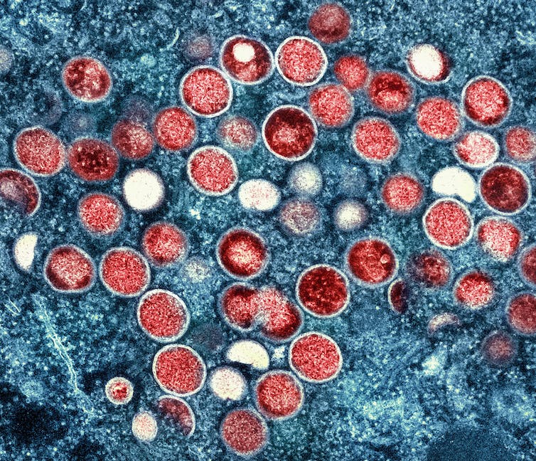 Image au microscope électronique de particules de variole du singe.