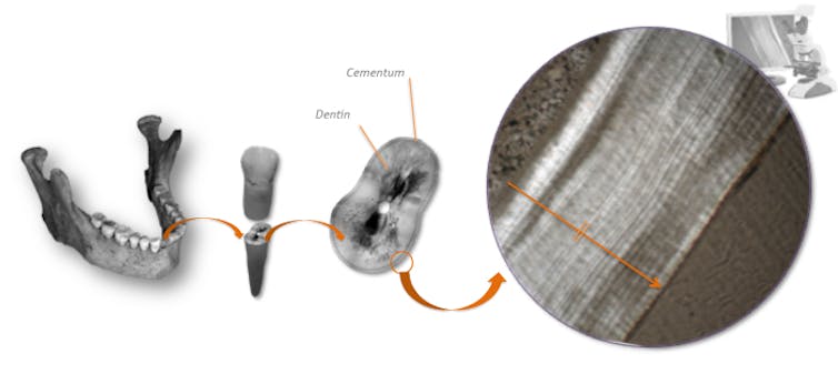 Une mâchoire avec des dents, une dent et une vue microscopique des couches du cément d'une dent.